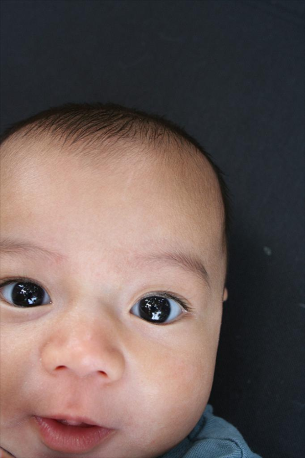 Ein Baby wird vor schwarzem Hintergrund gezeigt.