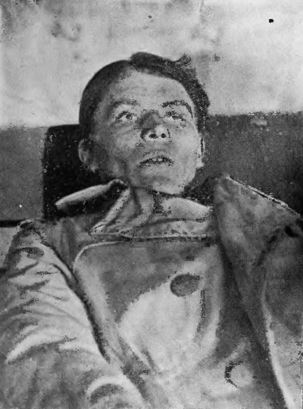 Ein altes Schwarz-Weiß-Foto eines Mannes im Krankenhausbett, der besorgt mit weit aufgerissenen Augen, leicht geöffnetem Mund und zusammengelegten Händen dasteht.